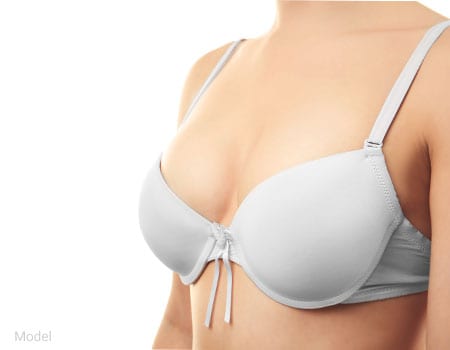Breast implant removal, Plastic Surgeon San Francisco
